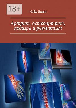 Артрит, остеоартрит, подагра и ревматизм