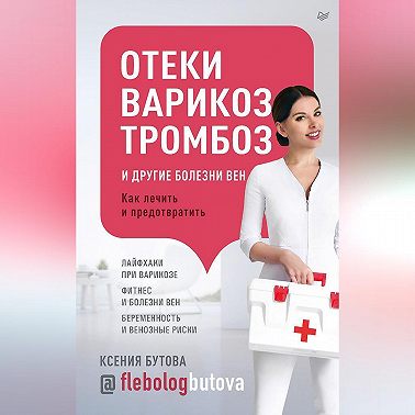 Отеки, варикоз, тромбоз и другие болезни вен. Как лечить и предотвратить