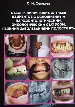 Обзор клинических случаев пациентов с осложнённым пародонтологическим, онкологическим статусом, редкими заболеваниями полости рта