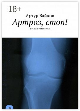 Артроз, стоп! Личный опыт врача