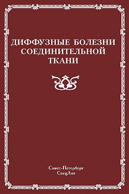 Диффузные болезни соединительной ткани