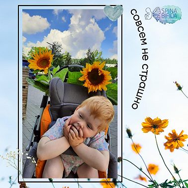 Формы spina bifida